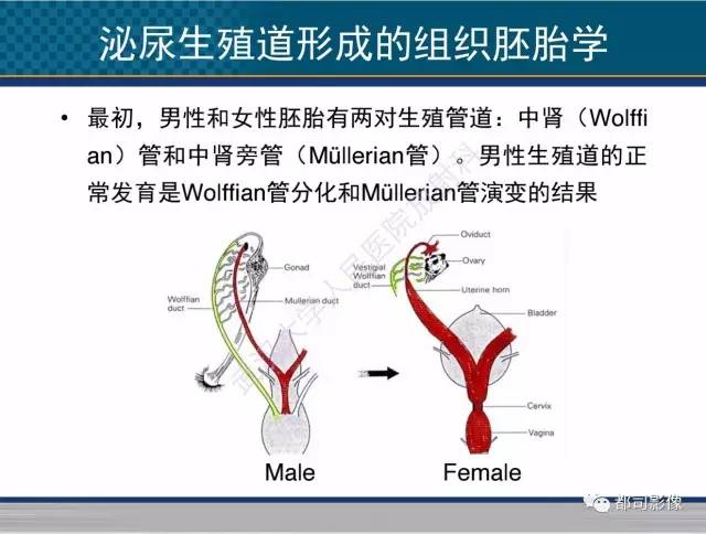 【PPT】男性下泌尿生殖道囊肿影像学鉴别诊断