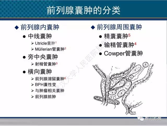 【PPT】男性下泌尿生殖道囊肿影像学鉴别诊断