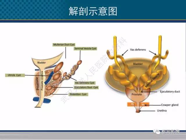 【PPT】男性下泌尿生殖道囊肿影像学鉴别诊断