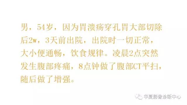 【病例】腹内疝并绞窄性肠梗阻1例CT