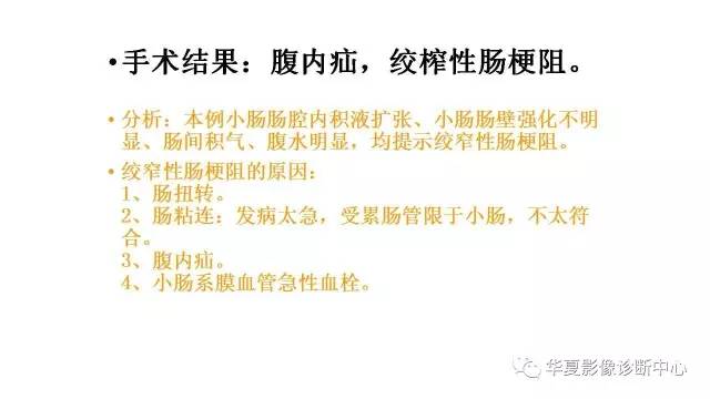 【病例】腹内疝并绞窄性肠梗阻1例CT