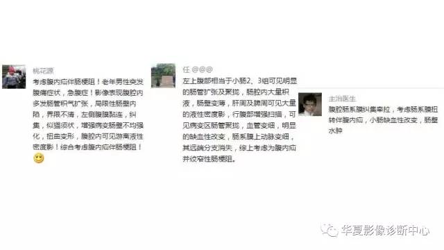 【病例】腹内疝并绞窄性肠梗阻1例CT