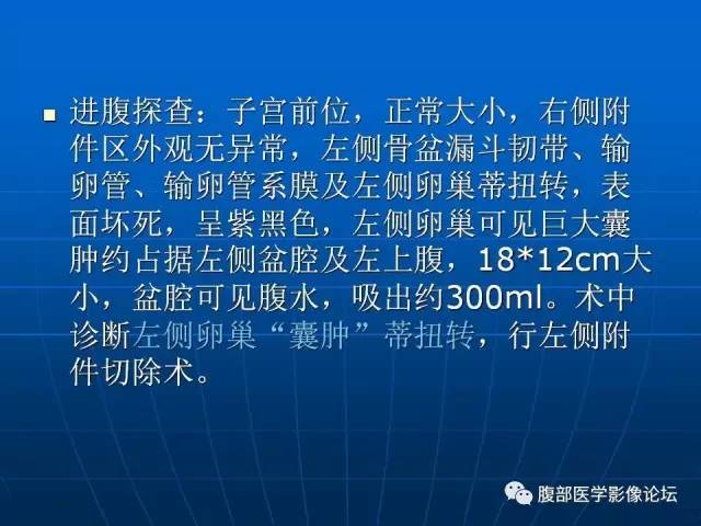 【病例】卵巢支持间质细胞肿瘤1例CT影像表现
