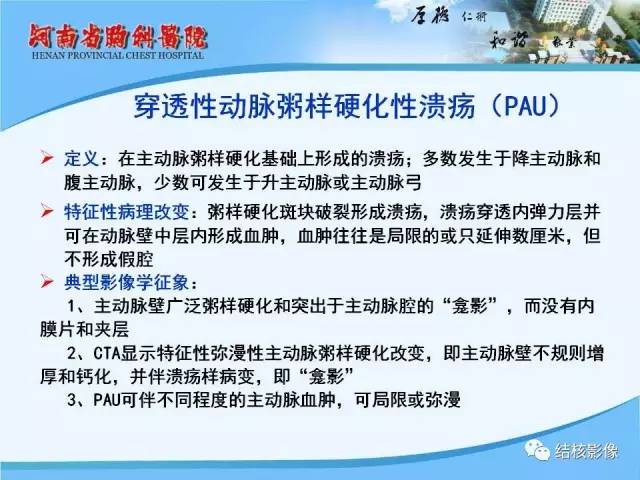 【PPT】胸痛相关疾病的影像诊断