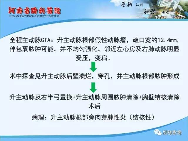 【PPT】胸痛相关疾病的影像诊断