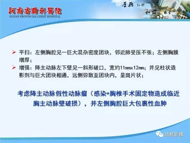【PPT】胸痛相关疾病的影像诊断