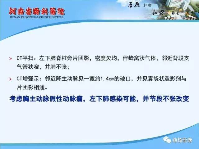 【PPT】胸痛相关疾病的影像诊断