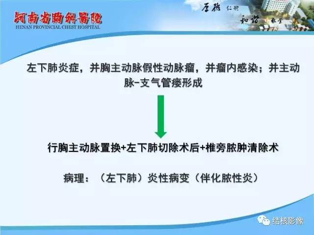 【PPT】胸痛相关疾病的影像诊断
