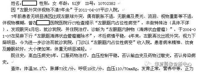 【病例】眶内海绵状血管瘤2例CT和MRI表现 【病例】眶内海绵状血管瘤2例CT和MRI表现