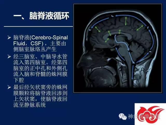 【PPT】脑脊液循环障碍