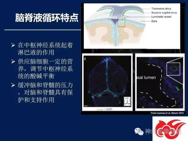 【PPT】脑脊液循环障碍