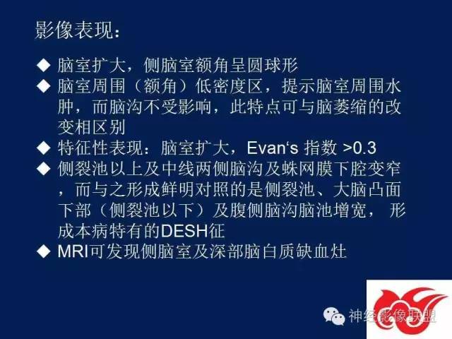 【PPT】脑脊液循环障碍