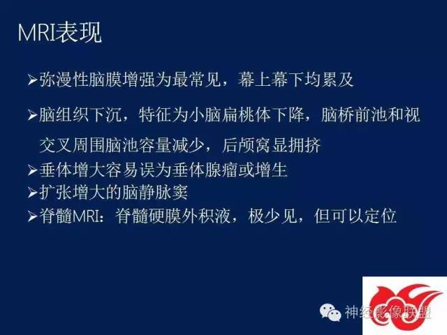 【PPT】脑脊液循环障碍