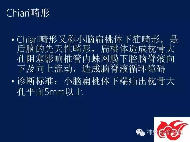 【PPT】脑脊液循环障碍