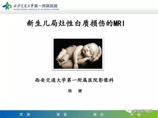 【PPT】新生儿局灶性白质损伤的MRI