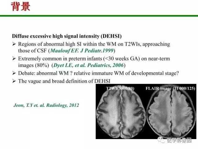 【PPT】新生儿局灶性白质损伤的MRI