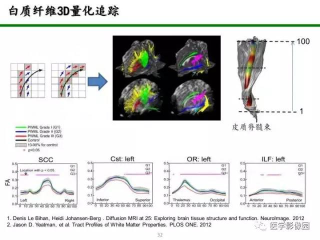【PPT】新生儿局灶性白质损伤的MRI