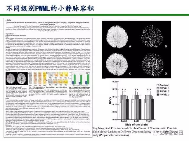 【PPT】新生儿局灶性白质损伤的MRI
