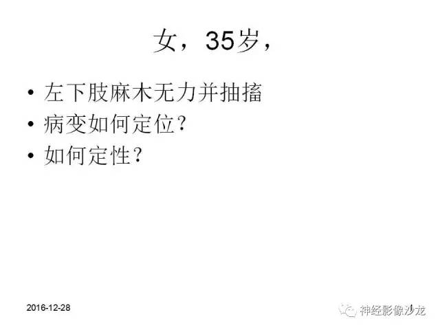【病例】右顶叶混合性胶质瘤1例MR影像讨论
