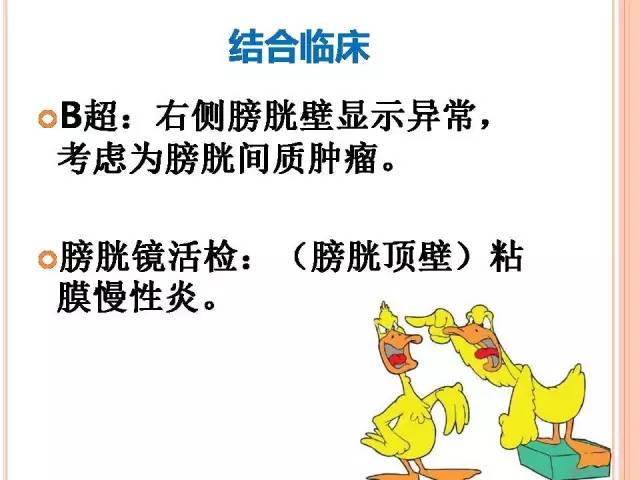 【病例】膀胱副神经节瘤1例CT影像表现