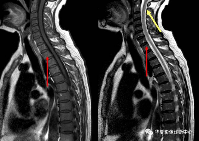 必看:9个连磁共振都可能漏诊或误诊疾病 必看:9个连磁共振都可能漏诊或误诊疾病