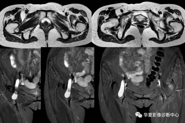 必看:9个连磁共振都可能漏诊或误诊疾病 必看:9个连磁共振都可能漏诊或误诊疾病