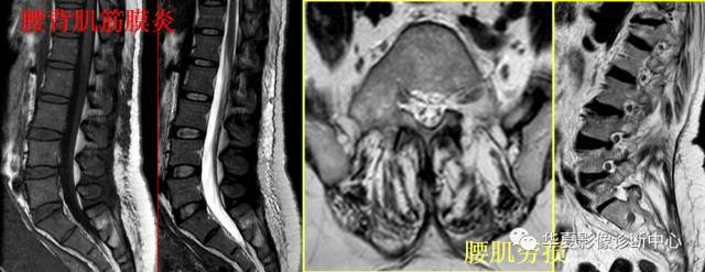 必看:9个连磁共振都可能漏诊或误诊疾病 必看:9个连磁共振都可能漏诊或误诊疾病