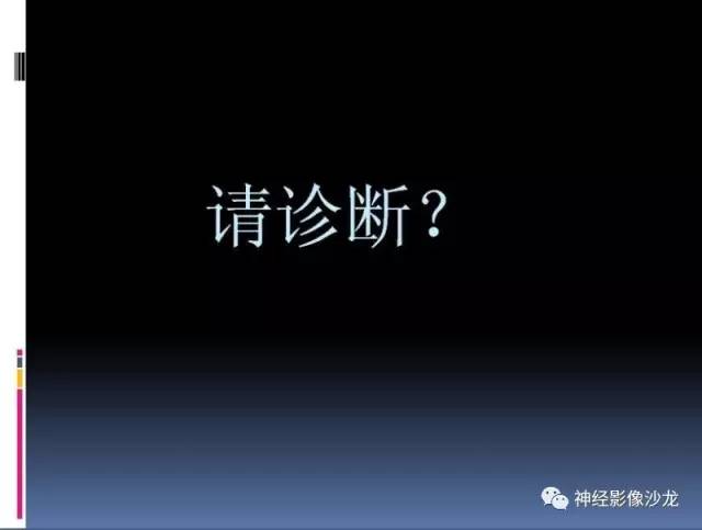 【病例】右小脑节细胞瘤1例MR影像表现