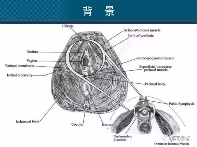 【PPT】女性尿道周围囊肿影像学鉴别诊断