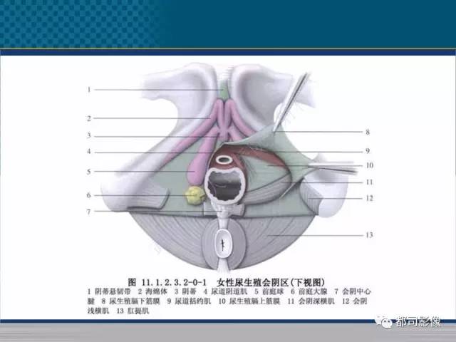 【PPT】女性尿道周围囊肿影像学鉴别诊断