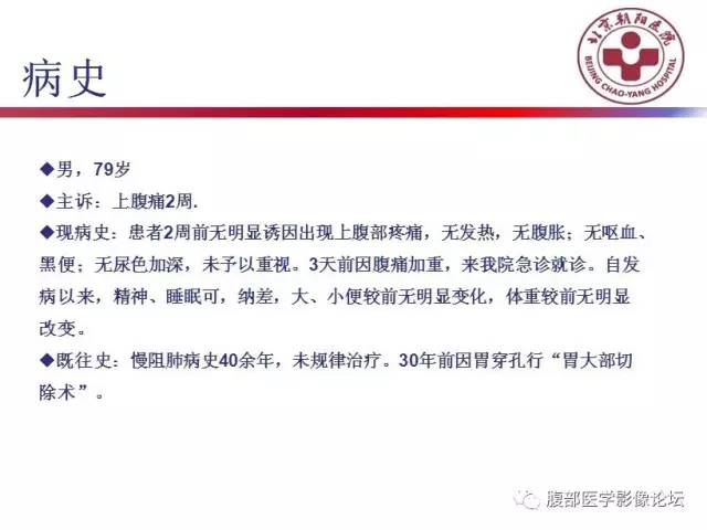 【病例】肝左外叶腺神经内分泌癌1例CT