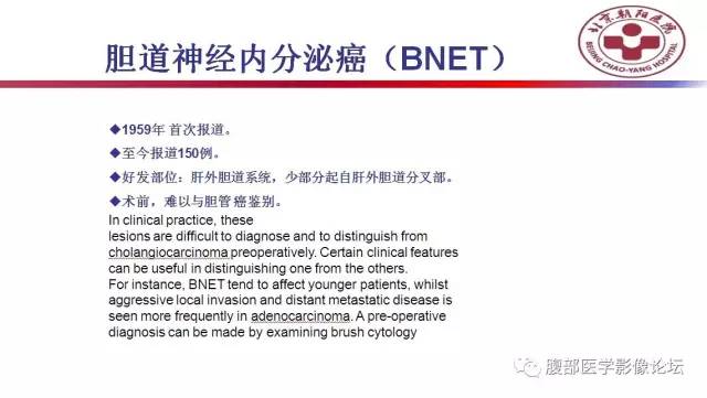 【病例】肝左外叶腺神经内分泌癌1例CT