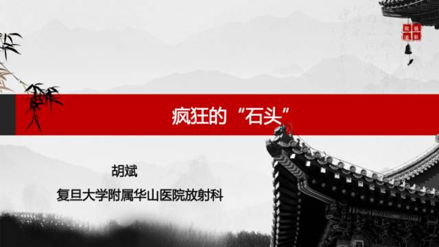 【病例】少突胶质细胞瘤1例CT及MR影像表现