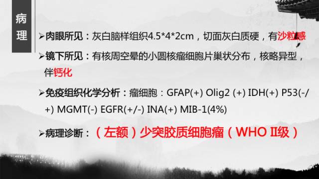 【病例】少突胶质细胞瘤1例CT及MR影像表现