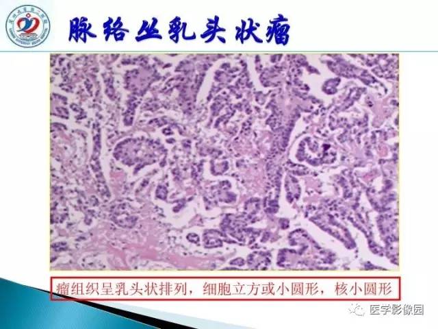 【PPT】儿童幕下脑肿瘤的诊断思路和功能MRI的规范使用
