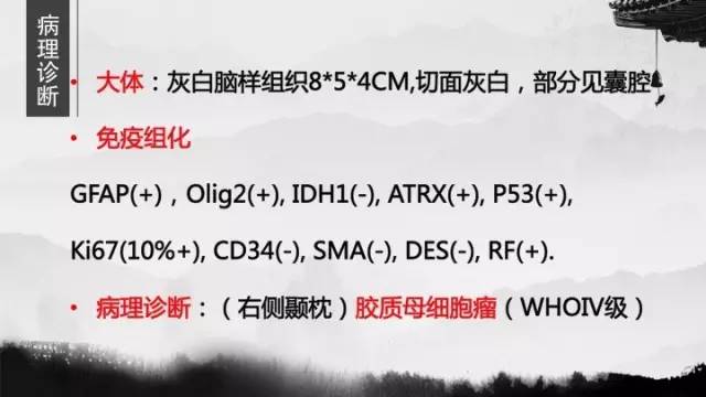 【病例】胶质母细胞瘤1例MR影像表现