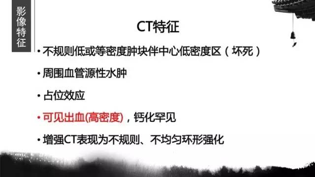 【病例】胶质母细胞瘤1例MR影像表现