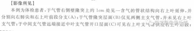 【病例】气管性支气管1例CT
