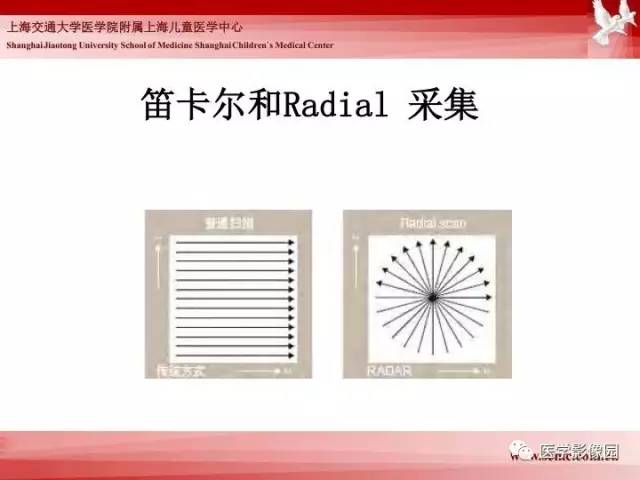 【PPT】胎儿神经系统MR检查规范与诊断思路