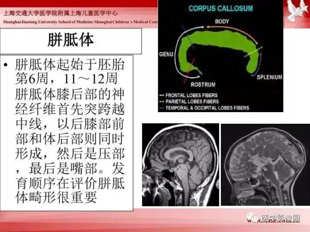 【PPT】胎儿神经系统MR检查规范与诊断思路