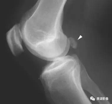 自动草稿