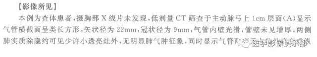 剑鞘状气管