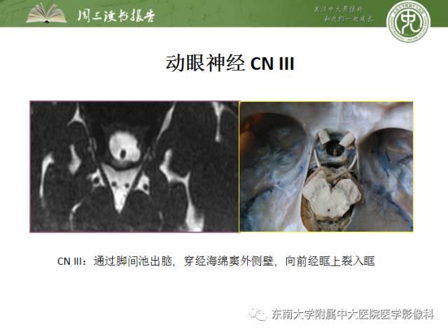【PPT】颅神经神经鞘瘤：影像学诊断方法