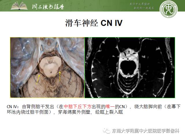 【PPT】颅神经神经鞘瘤：影像学诊断方法