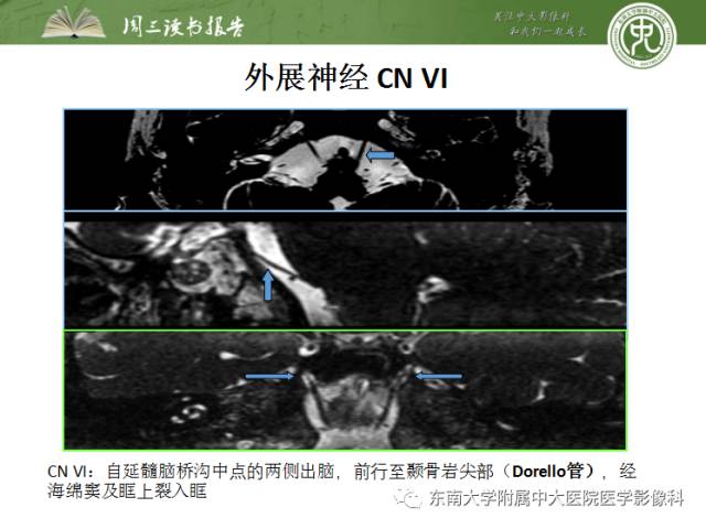 【PPT】颅神经神经鞘瘤：影像学诊断方法