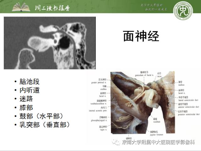 【PPT】颅神经神经鞘瘤：影像学诊断方法