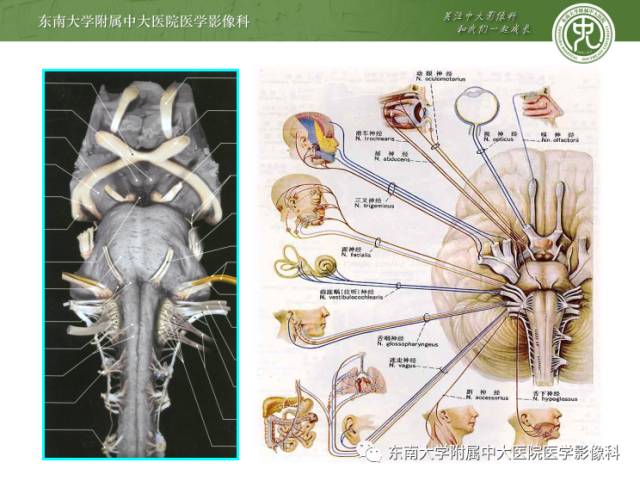 【PPT】颅神经神经鞘瘤：影像学诊断方法