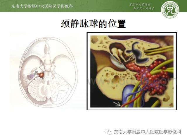 【PPT】颅神经神经鞘瘤：影像学诊断方法