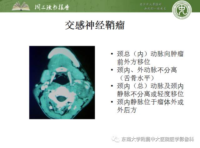 【PPT】颅神经神经鞘瘤：影像学诊断方法