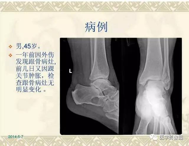自动草稿